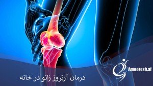 دوره آموزشی درمان آرتروز زانو در خانه